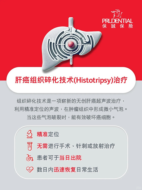 肝癌组织碎化技术.jpg